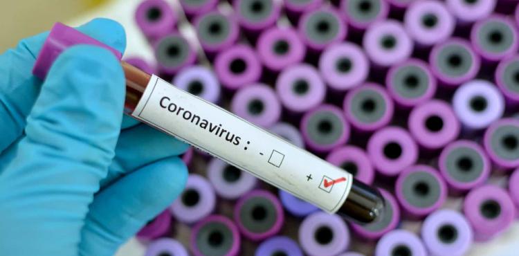 Aumenta para 34 o número de infetados por covid-19 no distrito de Bragança